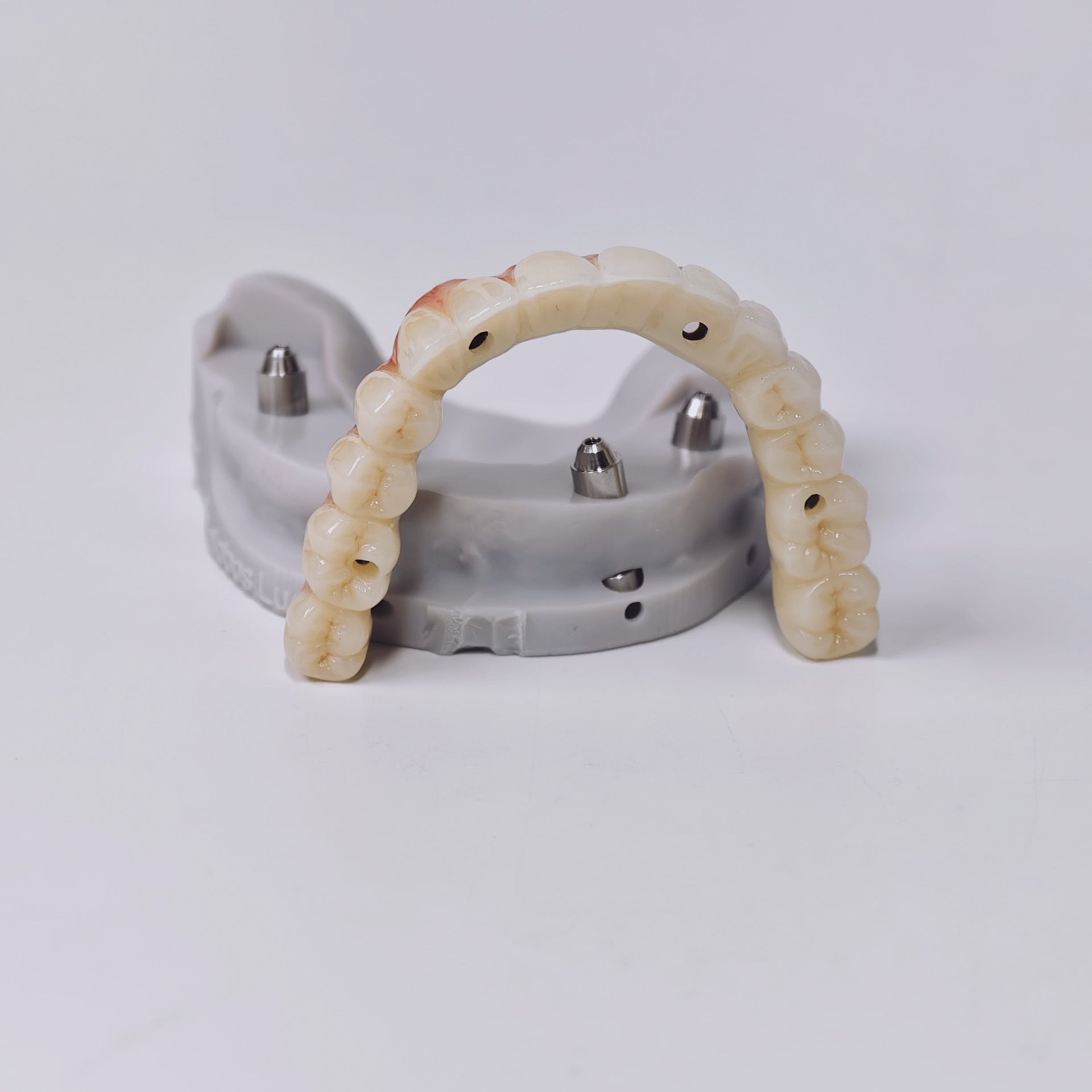 Ti-Bar Titanium Gold-Plated Metal Frame With Zirconia Bridge And Screw Retained