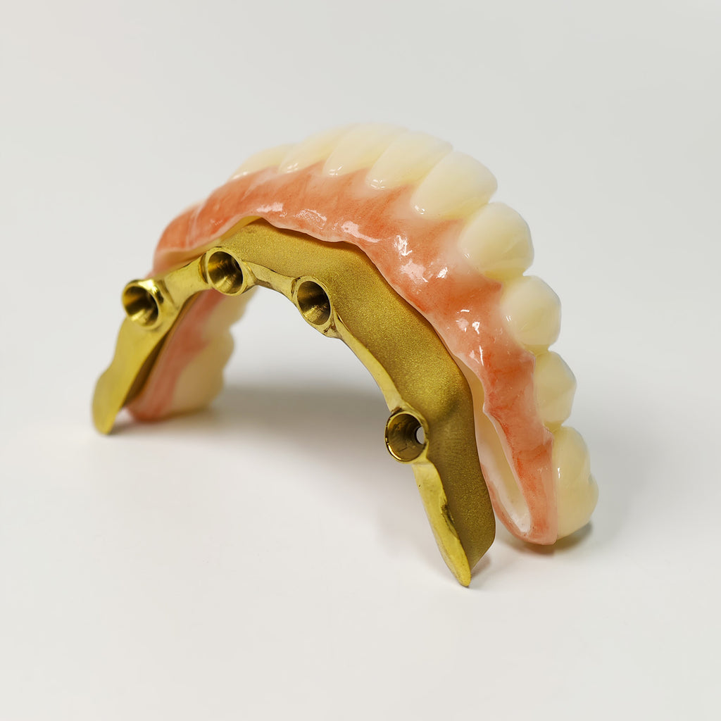 Ti-Bar Titanium Nitride Metal Frame With Zirconia Bridge For Full Arch Restoration