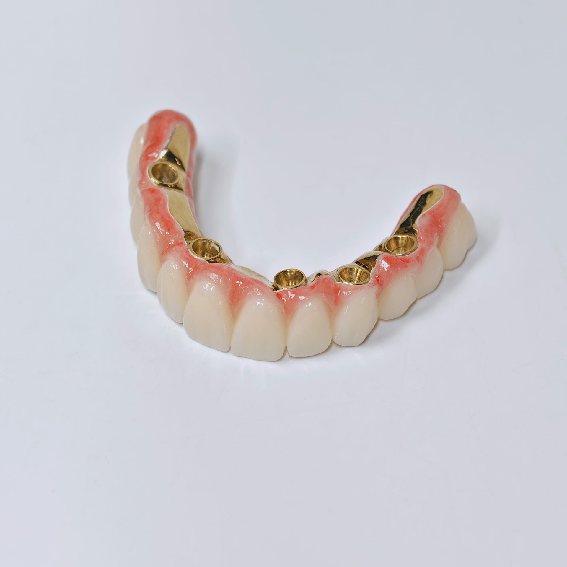 Ti-Bar Titanium Nitride Metal Frame With Zirconia Bridge For Full Arch Restoration