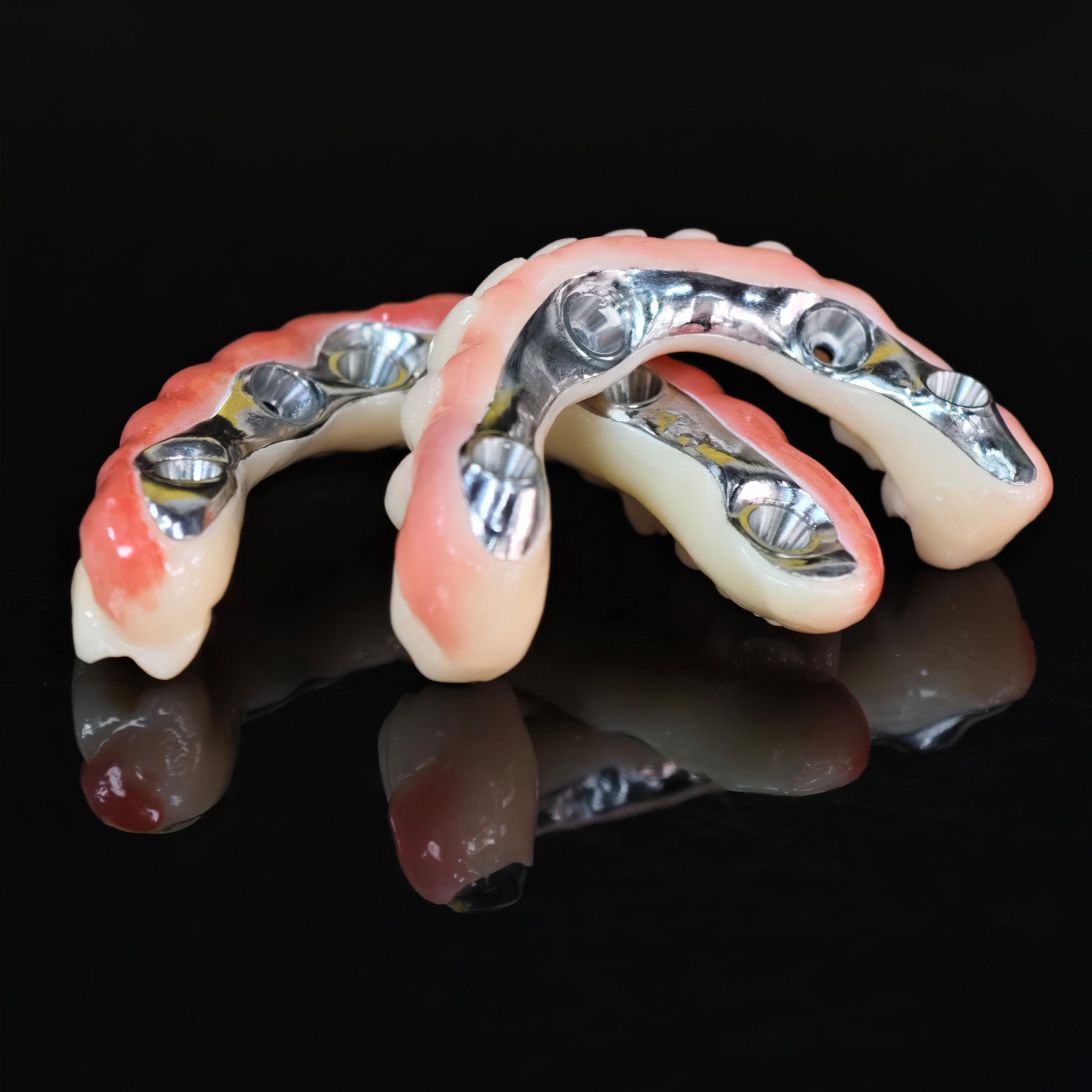 Ti-Bar Titanium Nitride Metal Frame With Zirconia Bridge For Full Arch Restoration