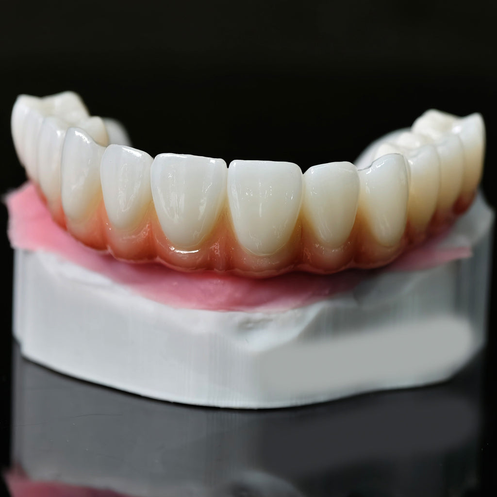 Ti-Bar Titanium Nitride Metal Frame With Zirconia Bridge For Full Arch Restoration