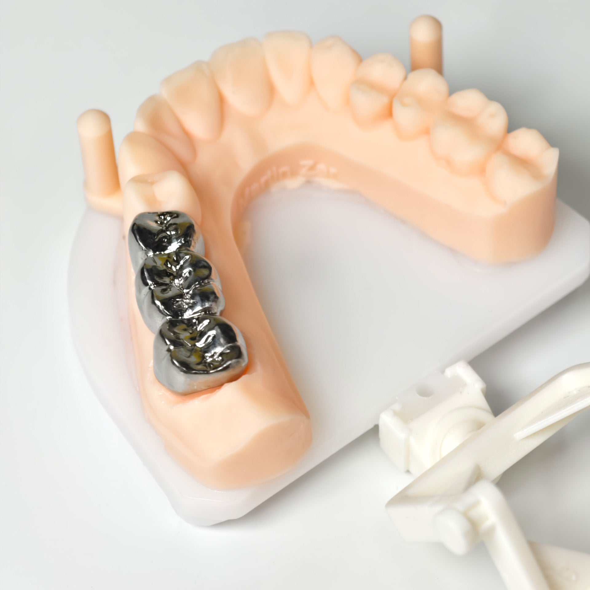 Titanium Crown With Cement Retained
