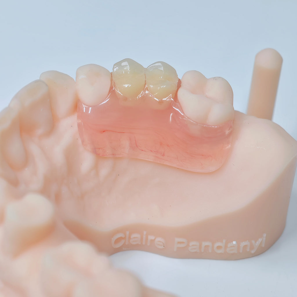 Valplast Denture Beautiful And Elastic Flexible Partial Natural Appearance
