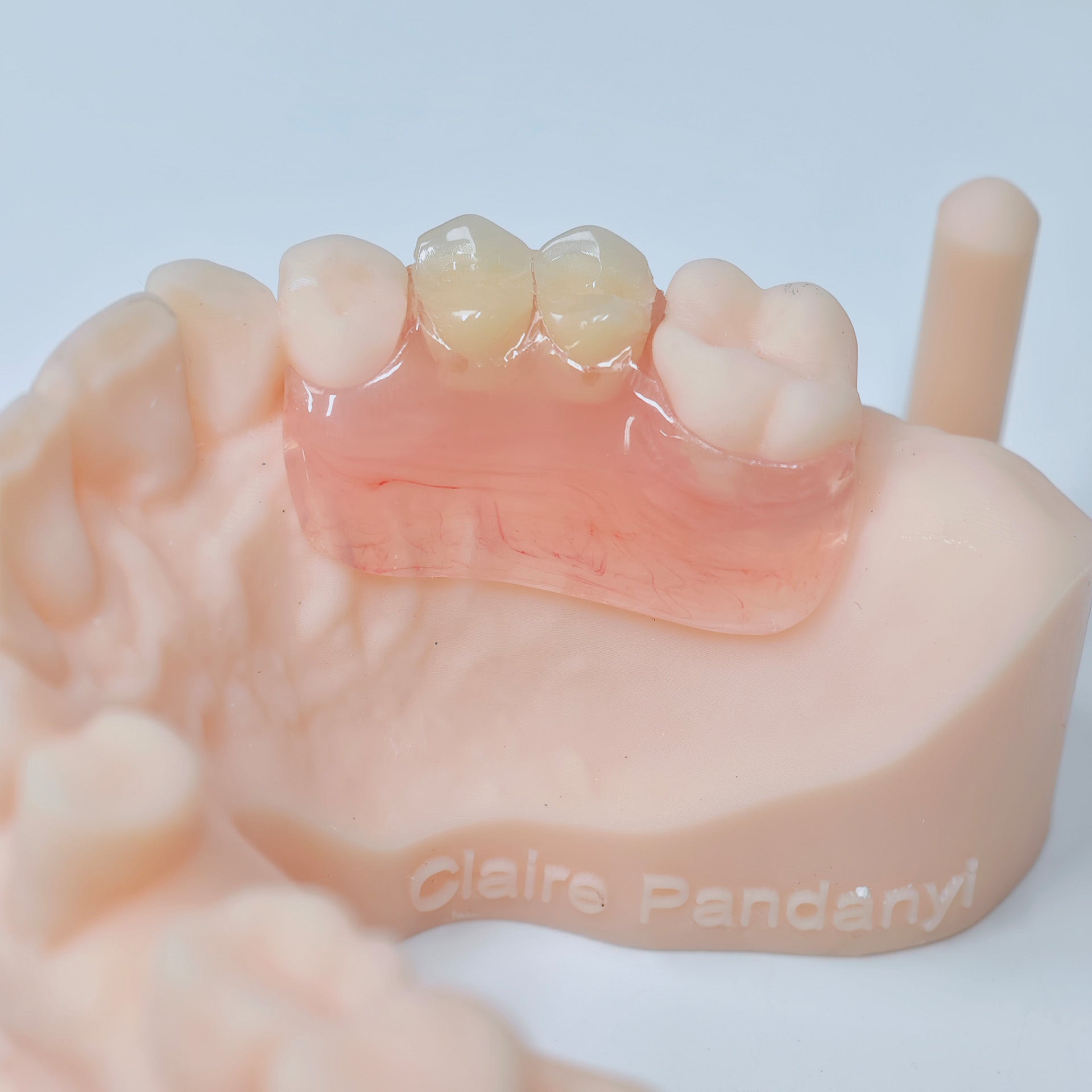 Valplast Denture Beautiful And Elastic Flexible Partial Natural Appearance