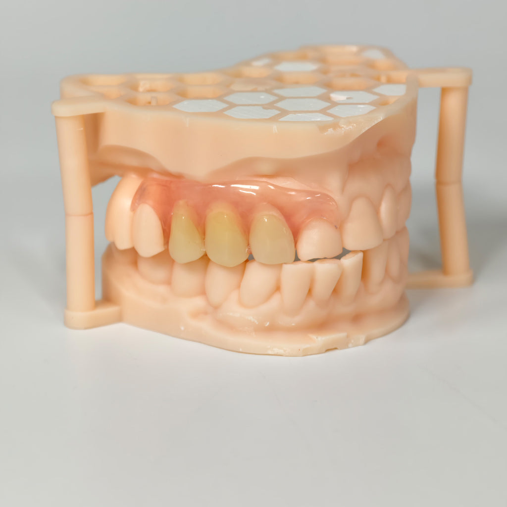 Valplast Denture Beautiful And Elastic Flexible Partial Natural Appearance