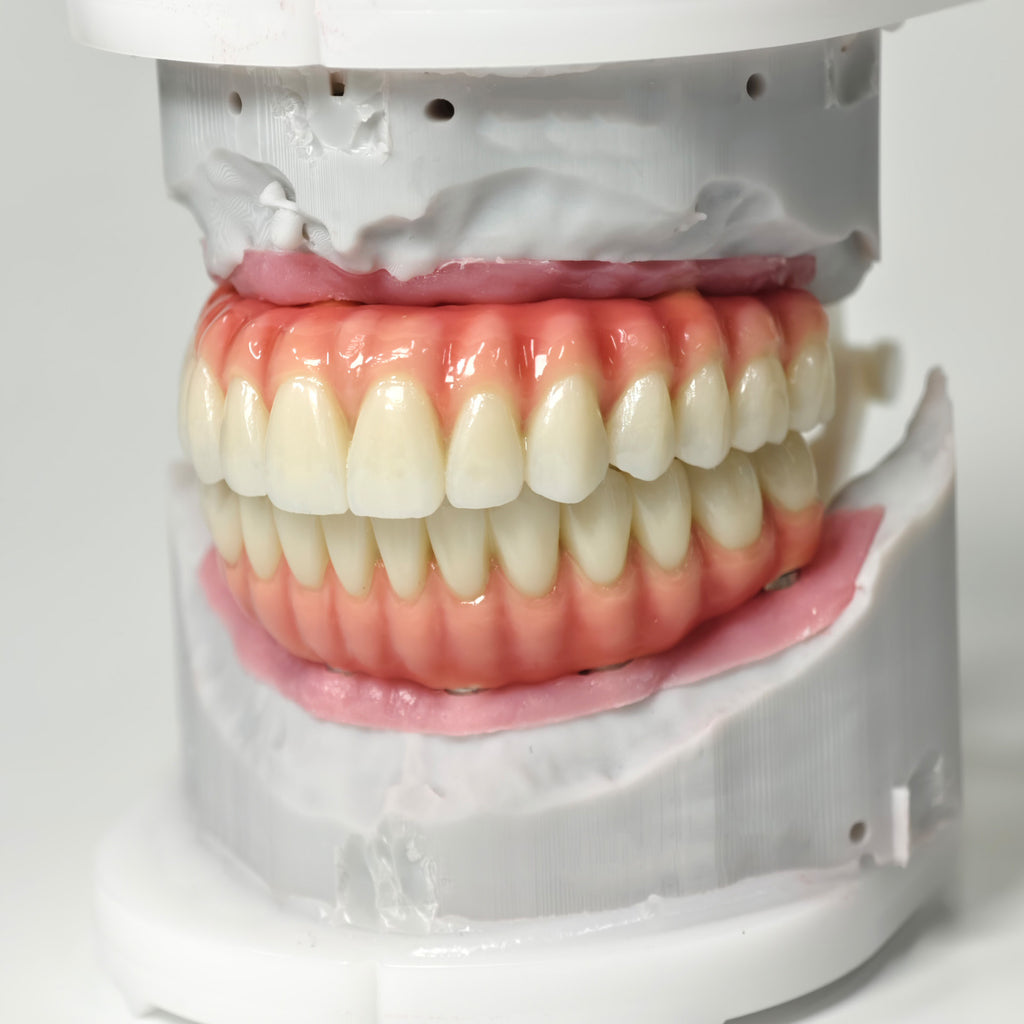 Zirconia-Enamel Hybrid Malo Bridge