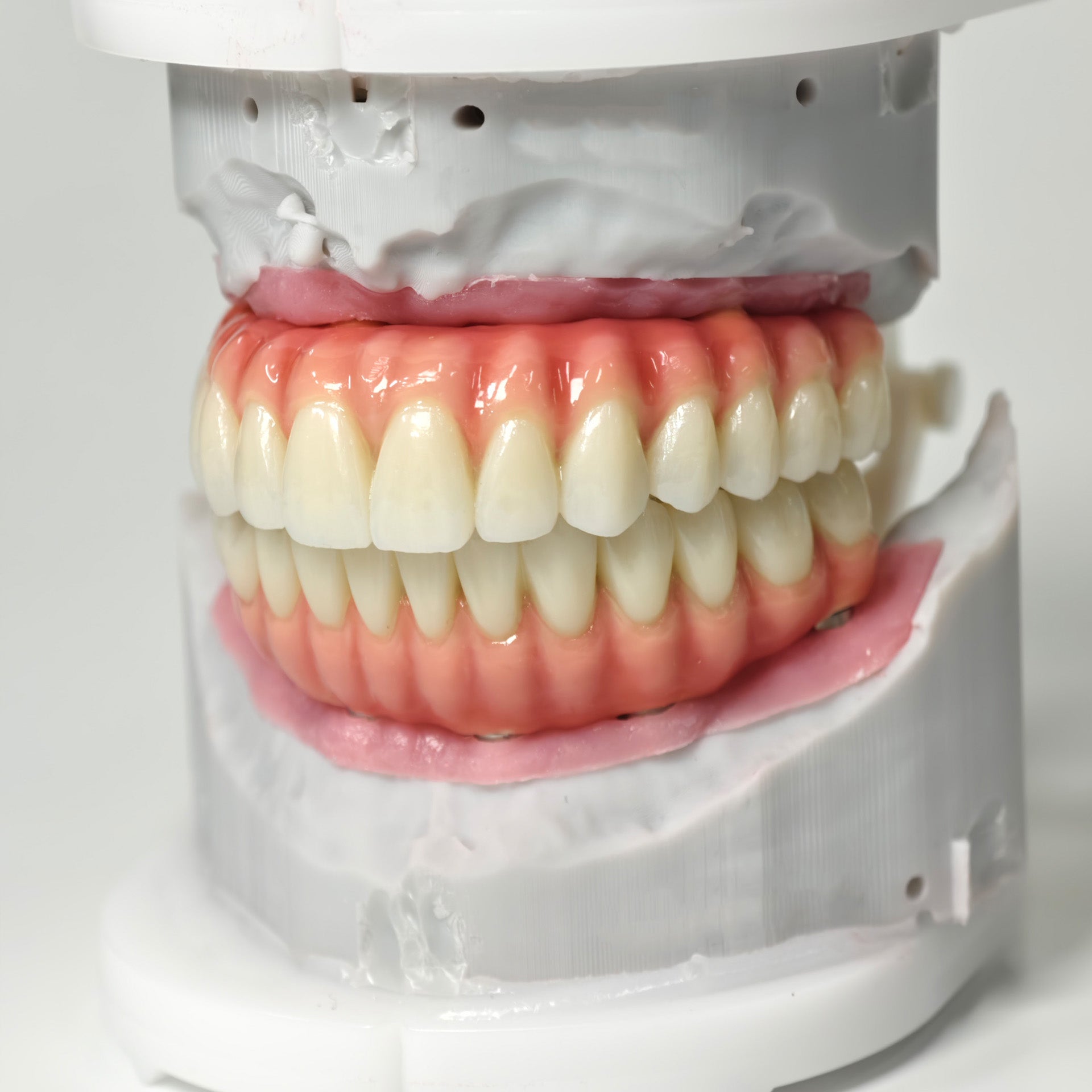 Zirconia-Enamel Hybrid Malo Bridge