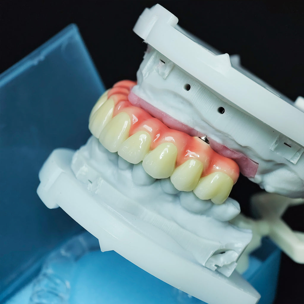 Zirconia-Enamel Hybrid Malo Bridge