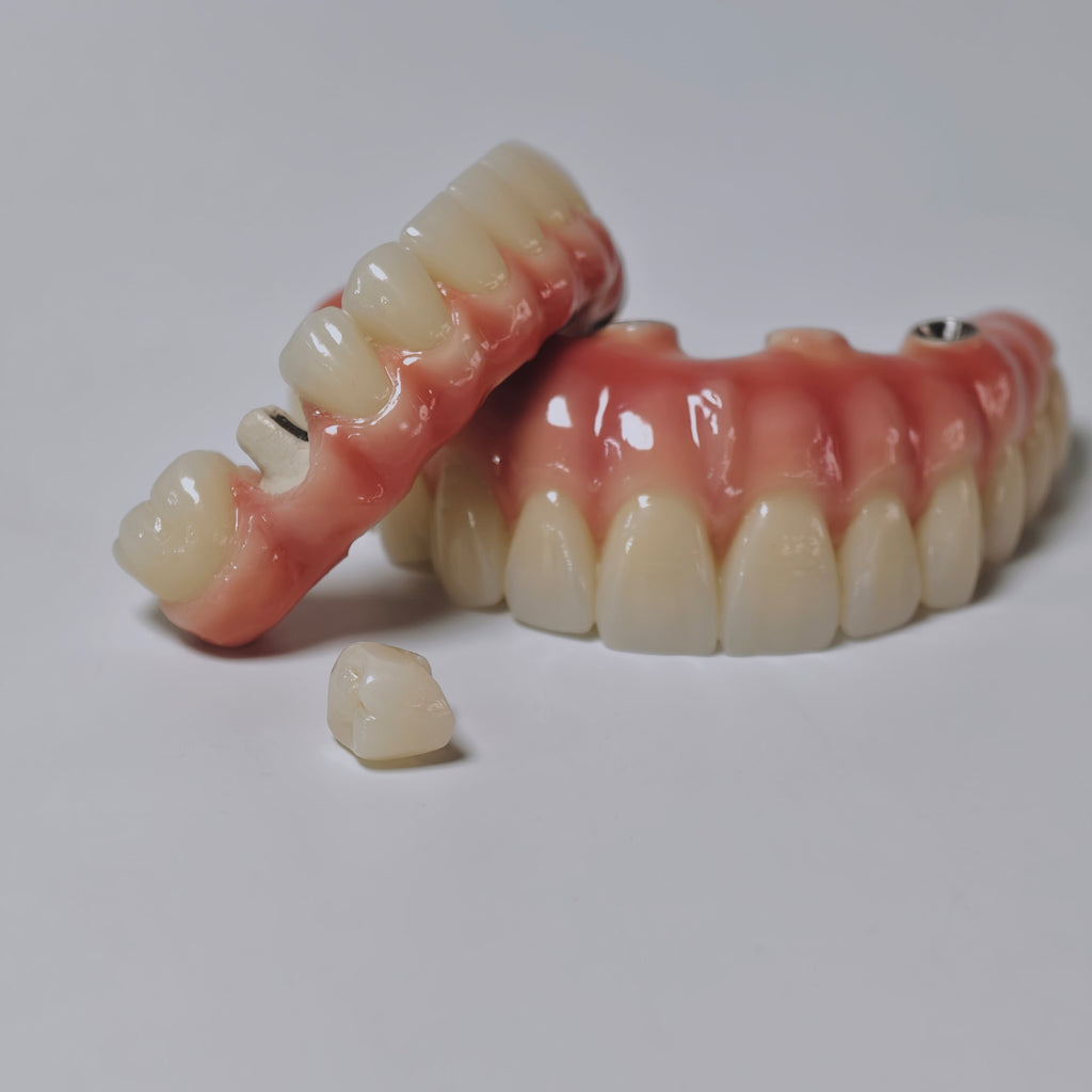 Zirconia-Enamel Hybrid Malo Bridge