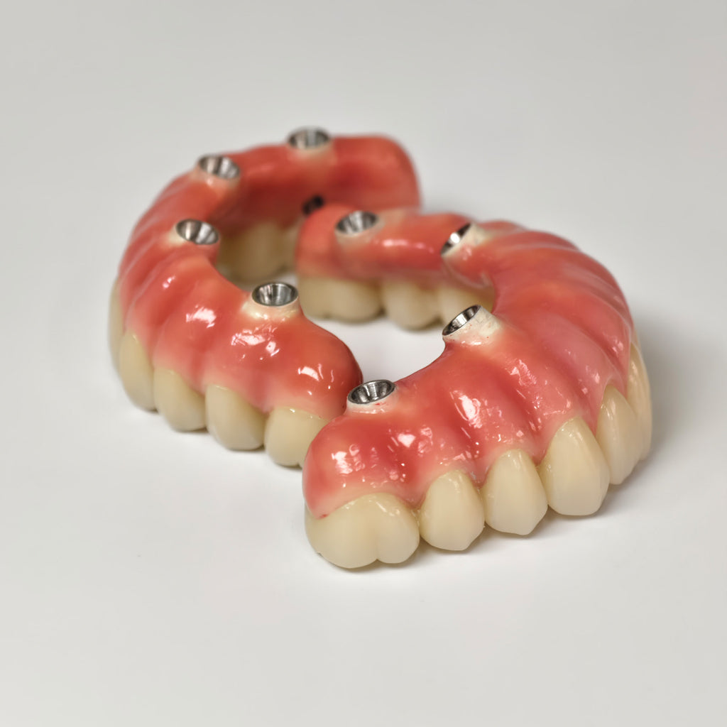 Zirconia-Enamel Hybrid Malo Bridge