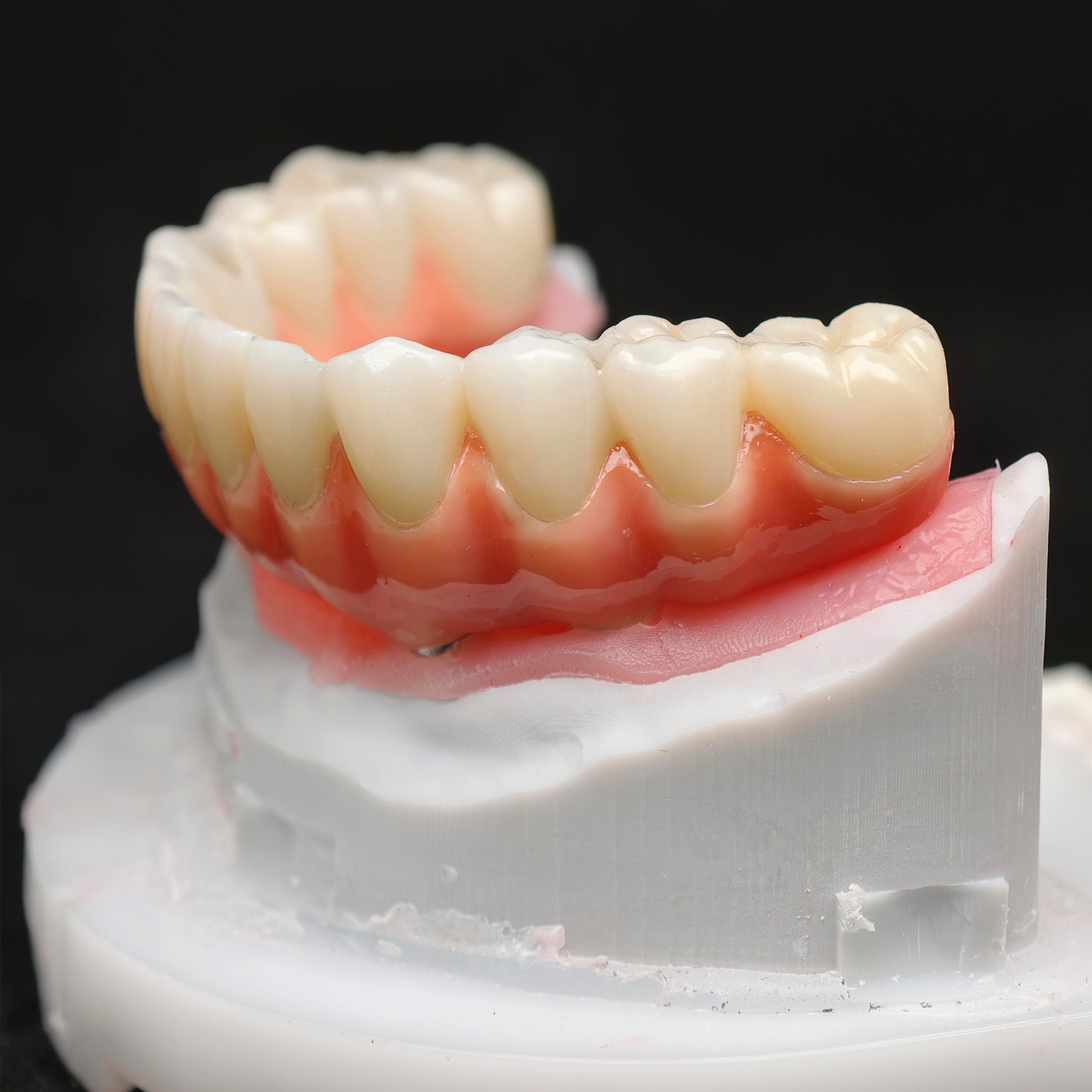 Zirconia-Enamel Hybrid Malo Bridge