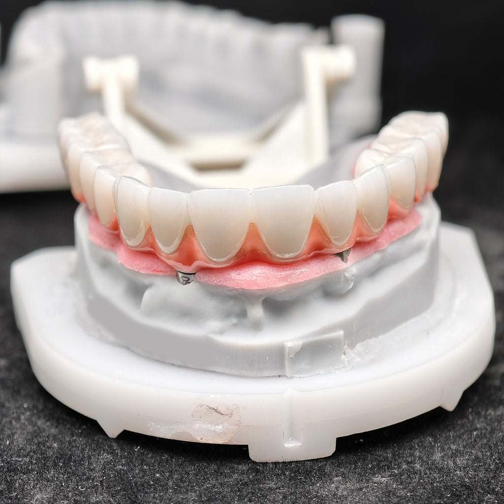 Zirconia-Enamel Hybrid Malo Bridge