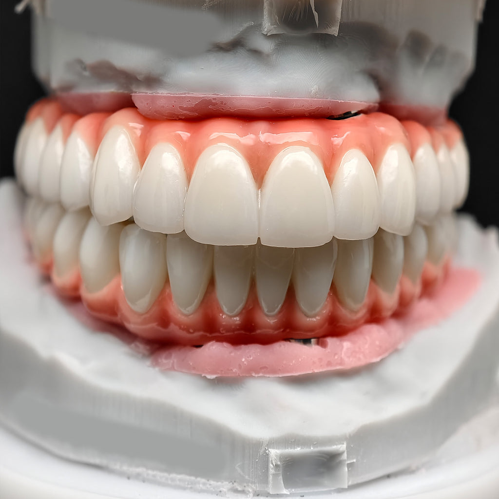 Zirconia-Enamel Hybrid Malo Bridge