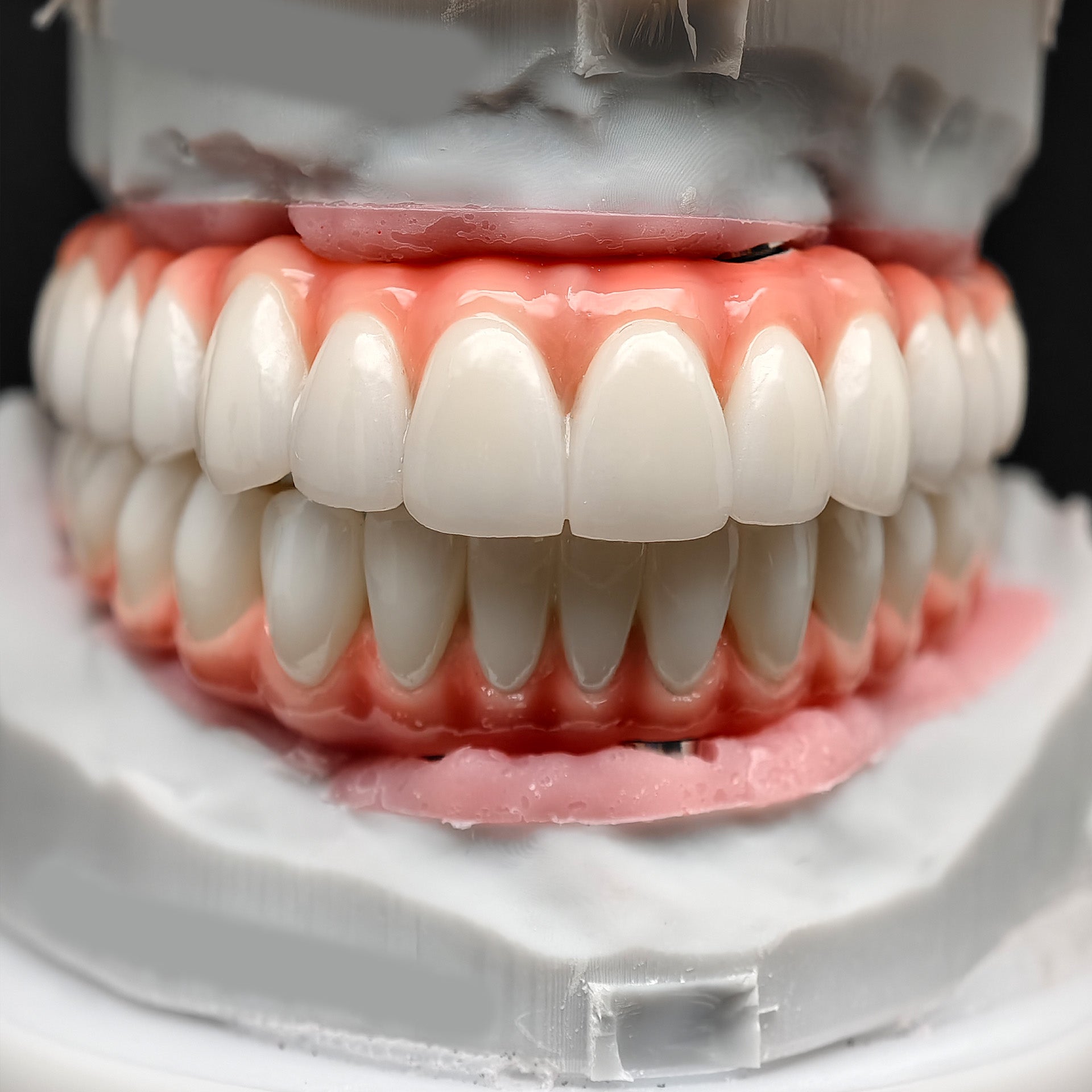 Zirconia-Enamel Hybrid Malo Bridge