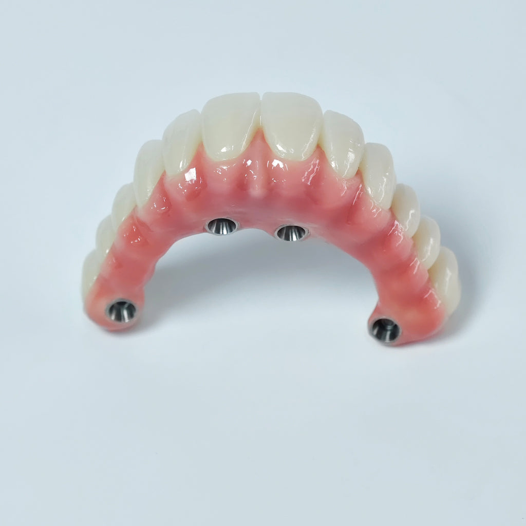 Zirconia-Enamel Hybrid Malo Bridge