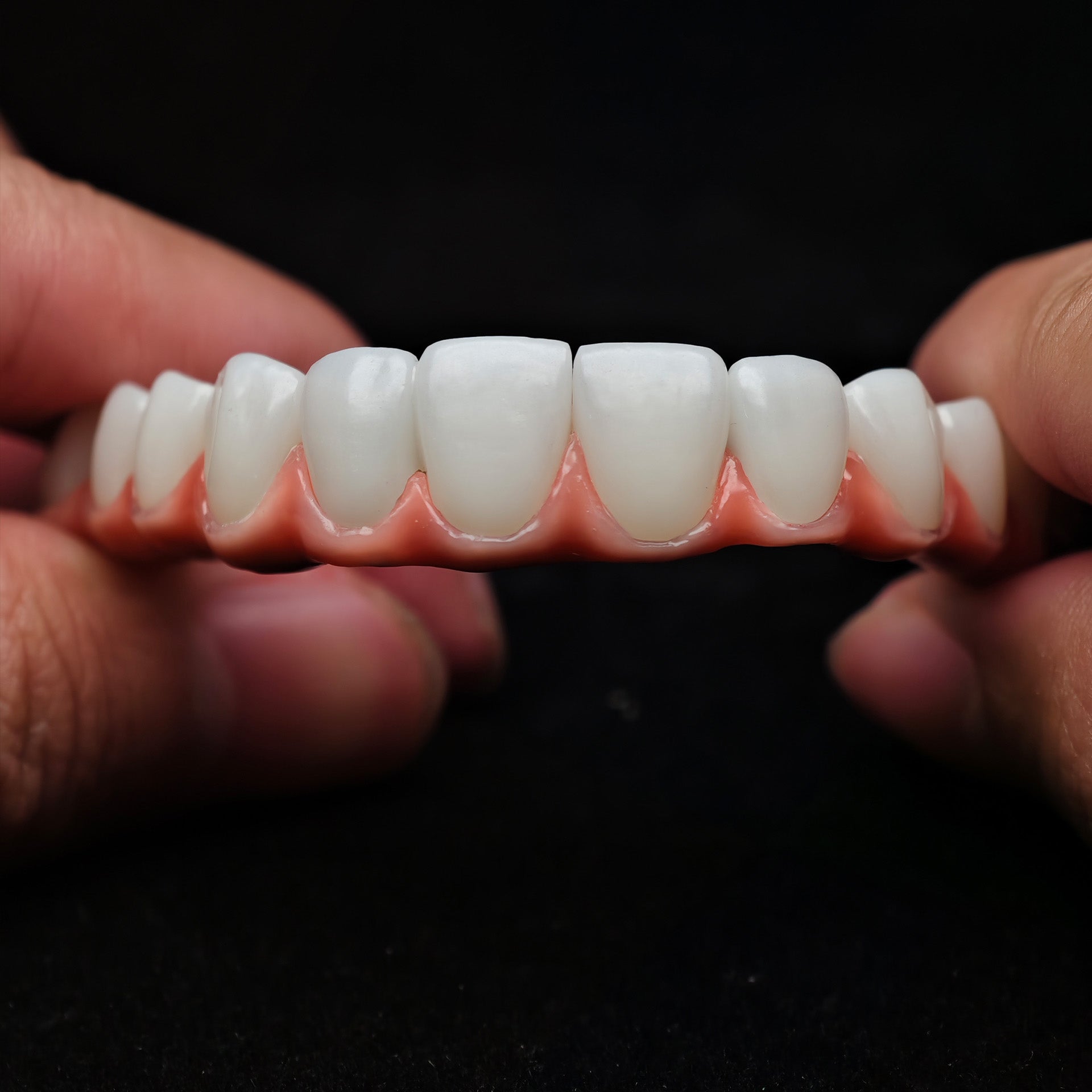Zirconia-Enamel Hybrid Malo Bridge