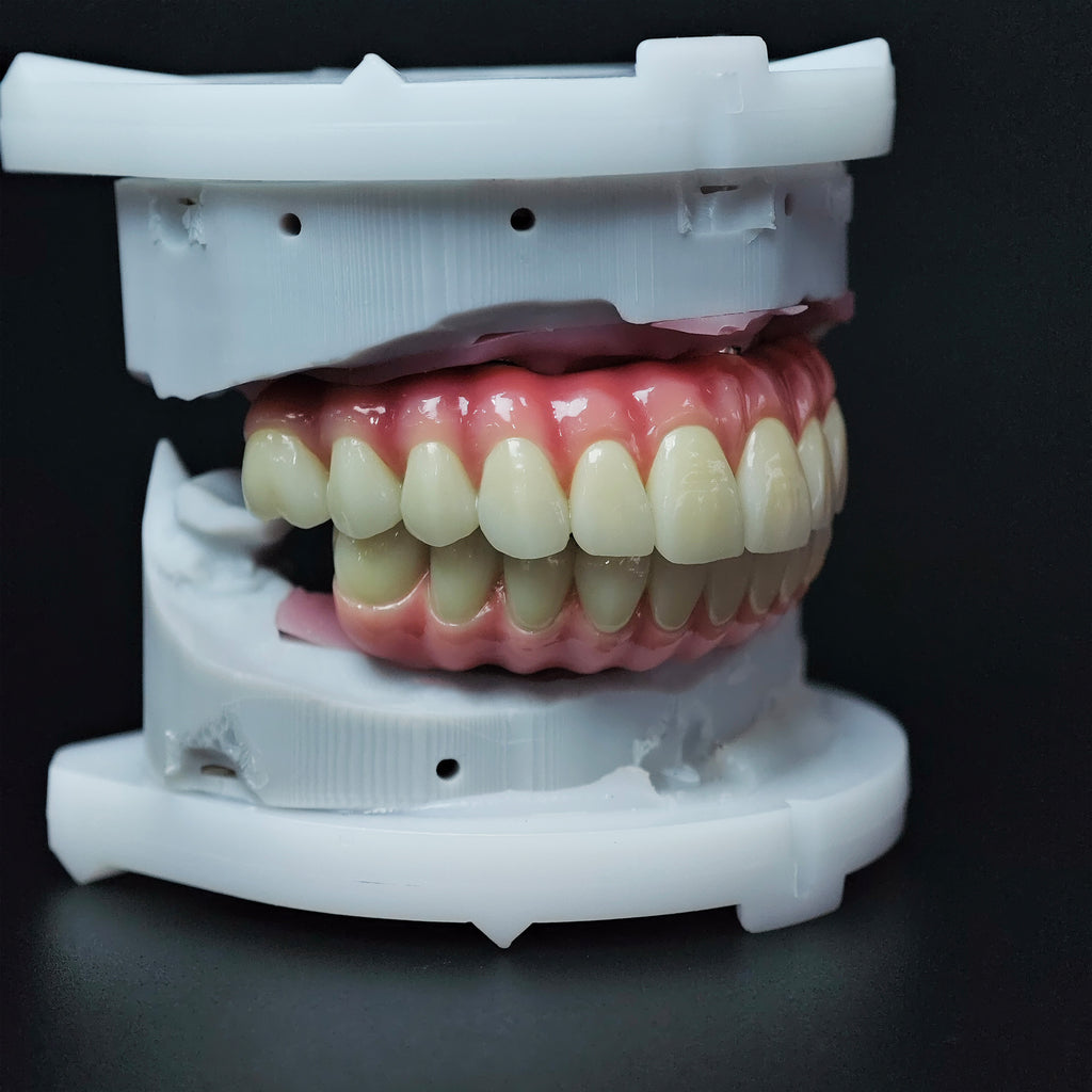 Zirconia-Enamel Hybrid Malo Bridge