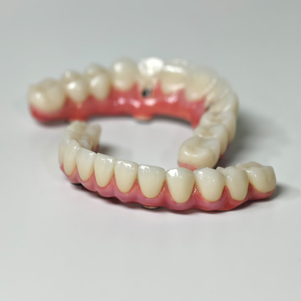 Zirconia-Enamel Hybrid Malo Bridge