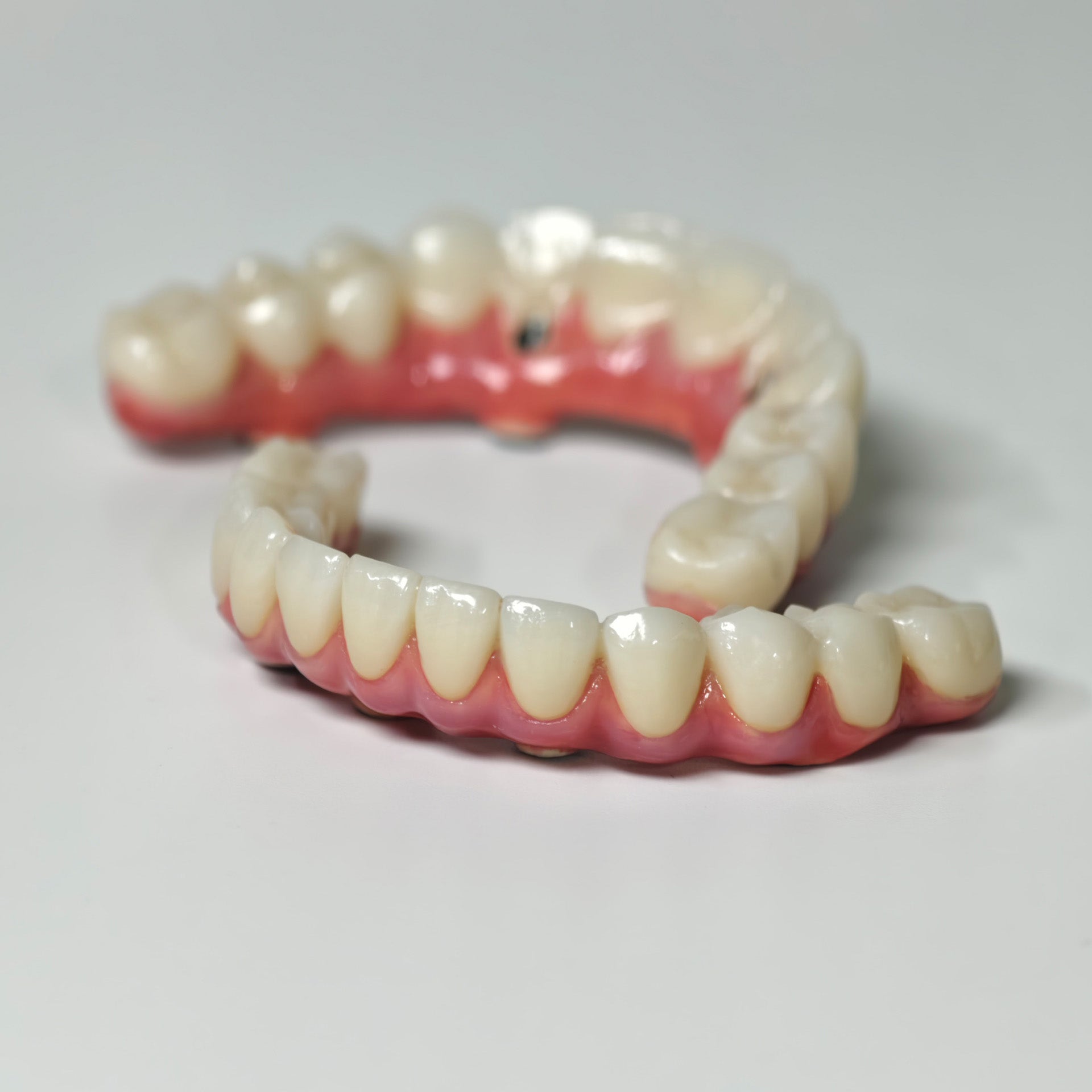 Zirconia-Enamel Hybrid Malo Bridge
