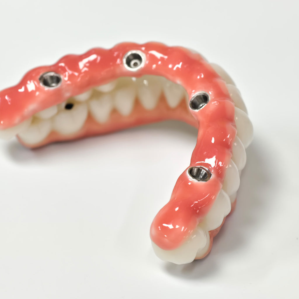 Zirconia-Enamel Hybrid Malo Bridge