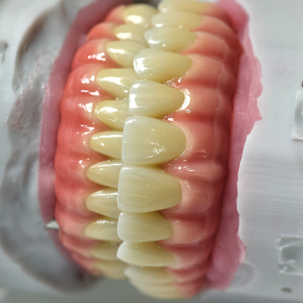 Zirconia-Enamel Hybrid Malo Bridge