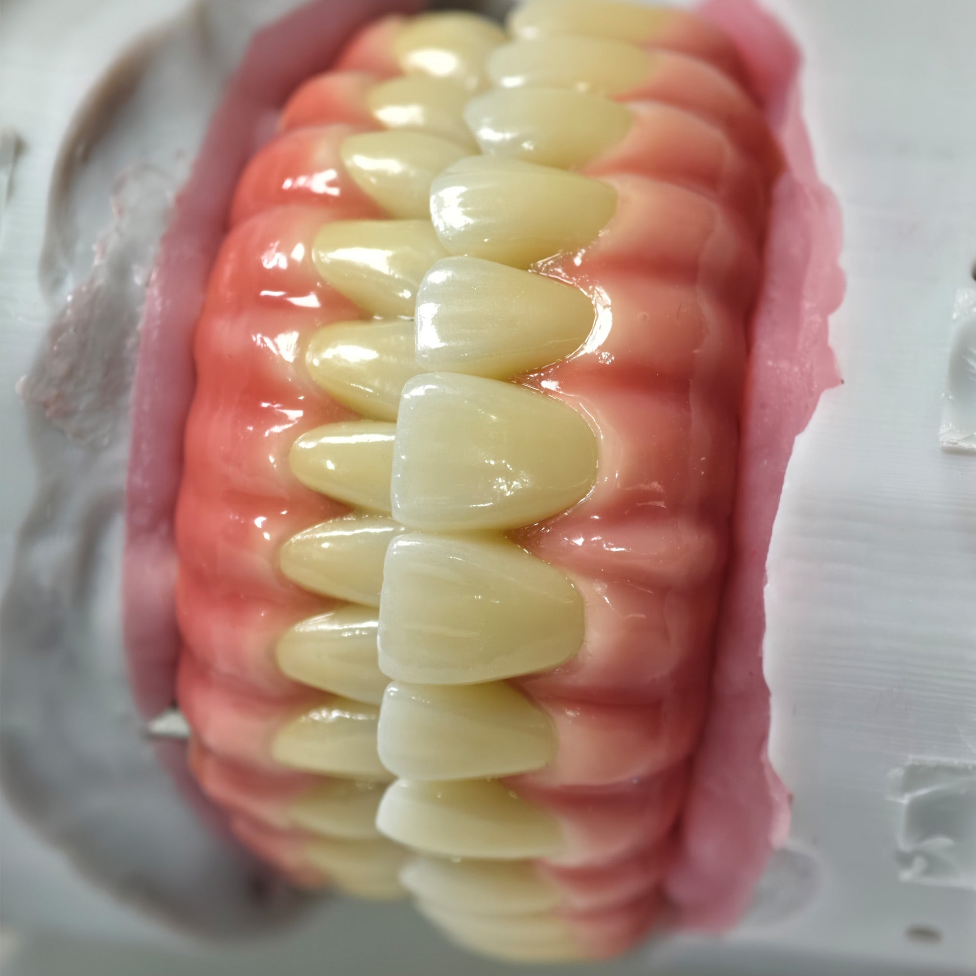 Zirconia-Enamel Hybrid Malo Bridge