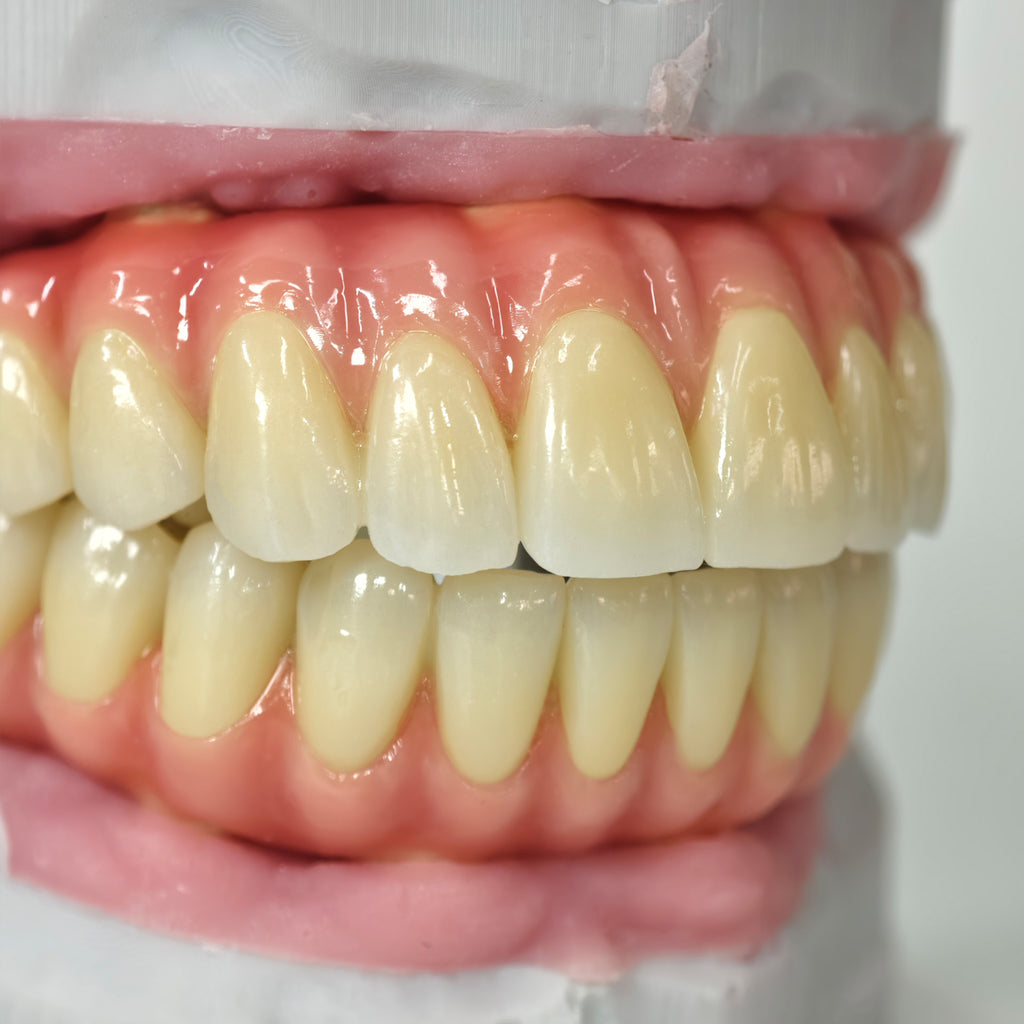 Zirconia-Enamel Hybrid Malo Bridge