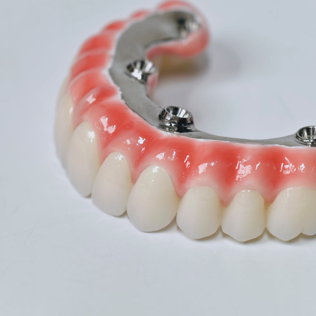 Zirconia-Enamel Hybrid Malo Bridge