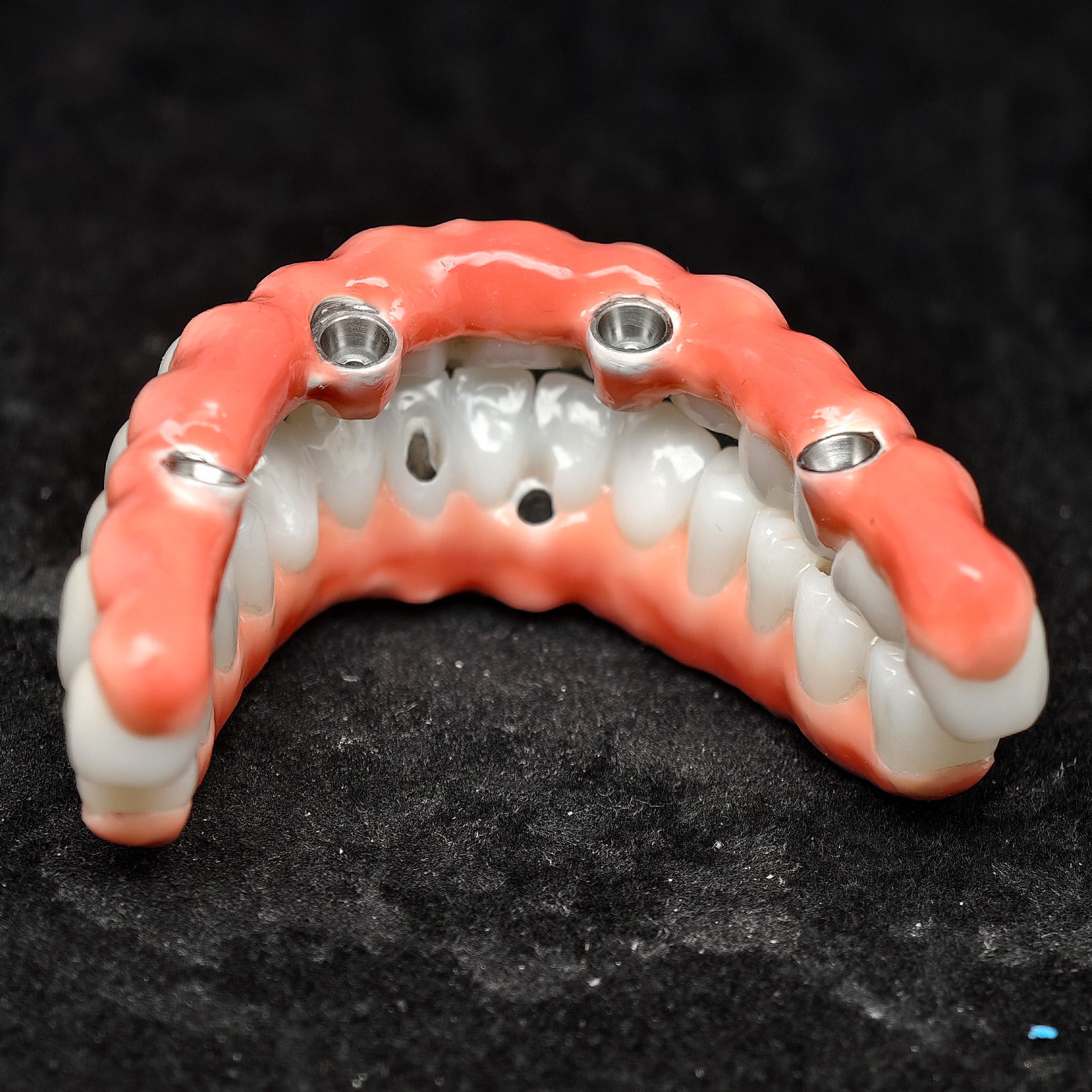 Zirconia-Enamel Hybrid Malo Bridge