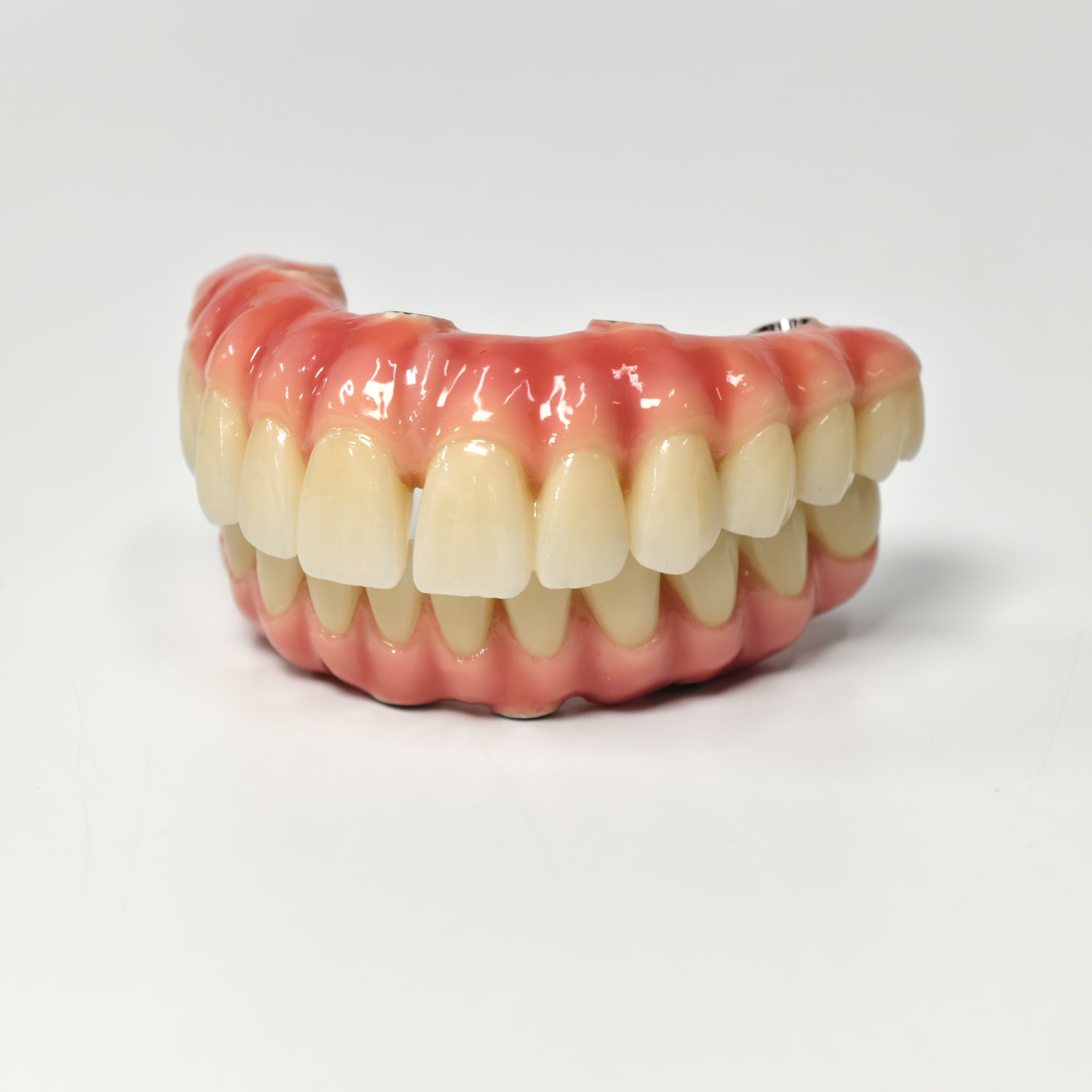 Zirconia-Enamel Hybrid Malo Bridge