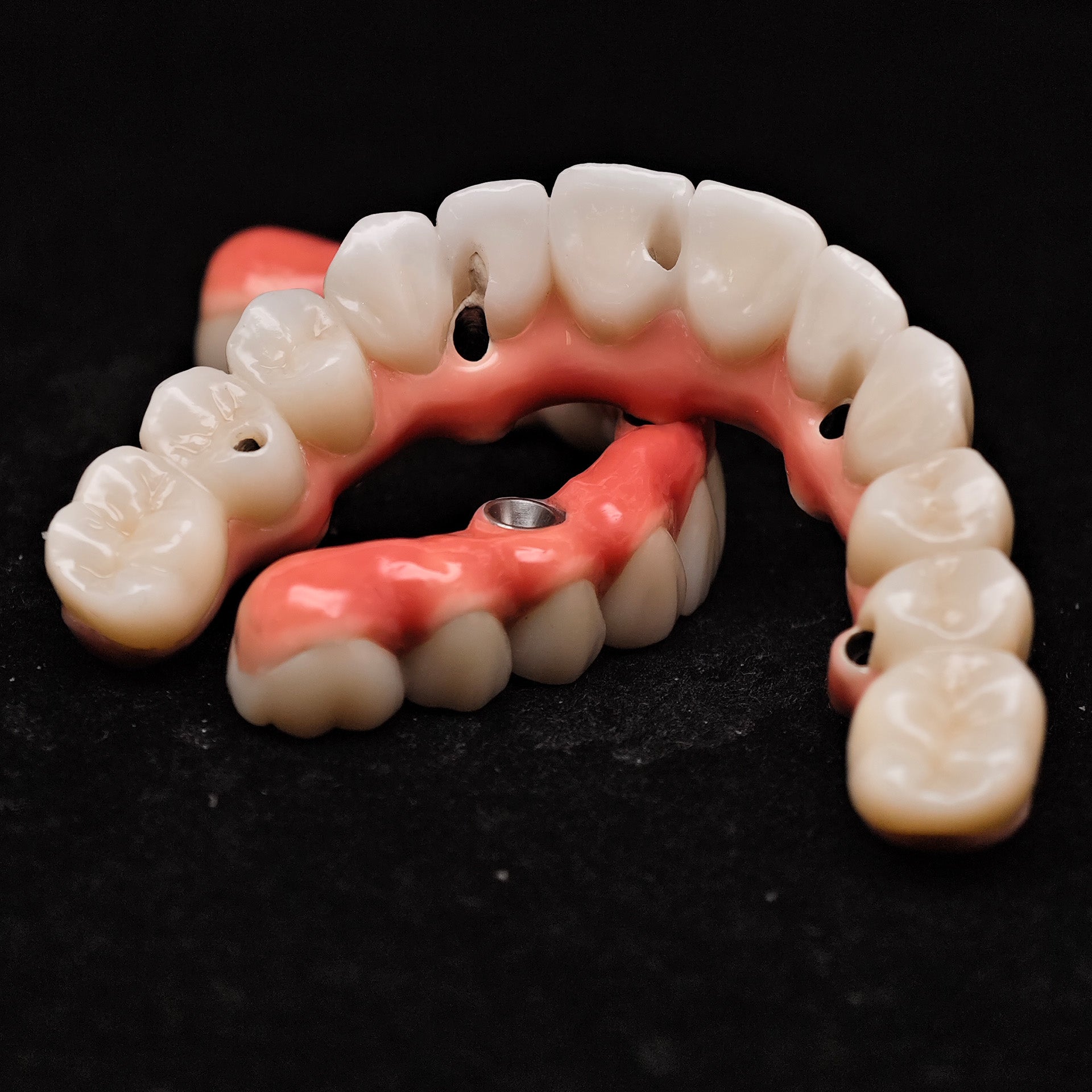 Zirconia-Enamel Hybrid Malo Bridge