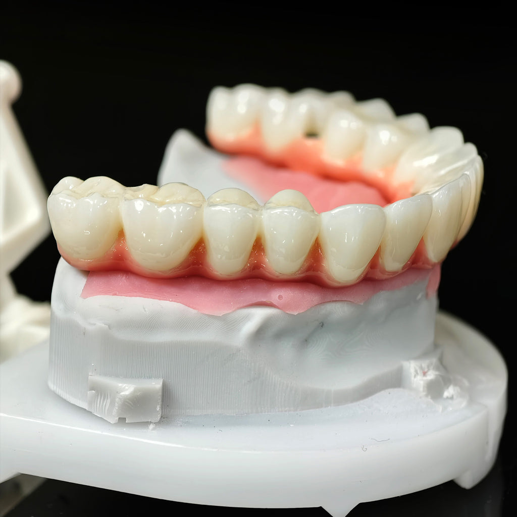 Zirconia-Enamel Hybrid Malo Bridge