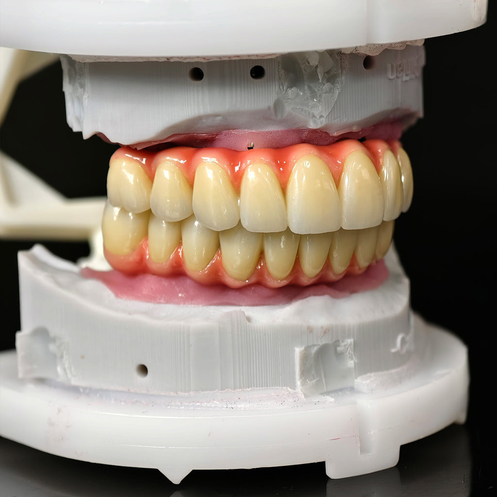 Zirconia-Enamel Hybrid Malo Bridge