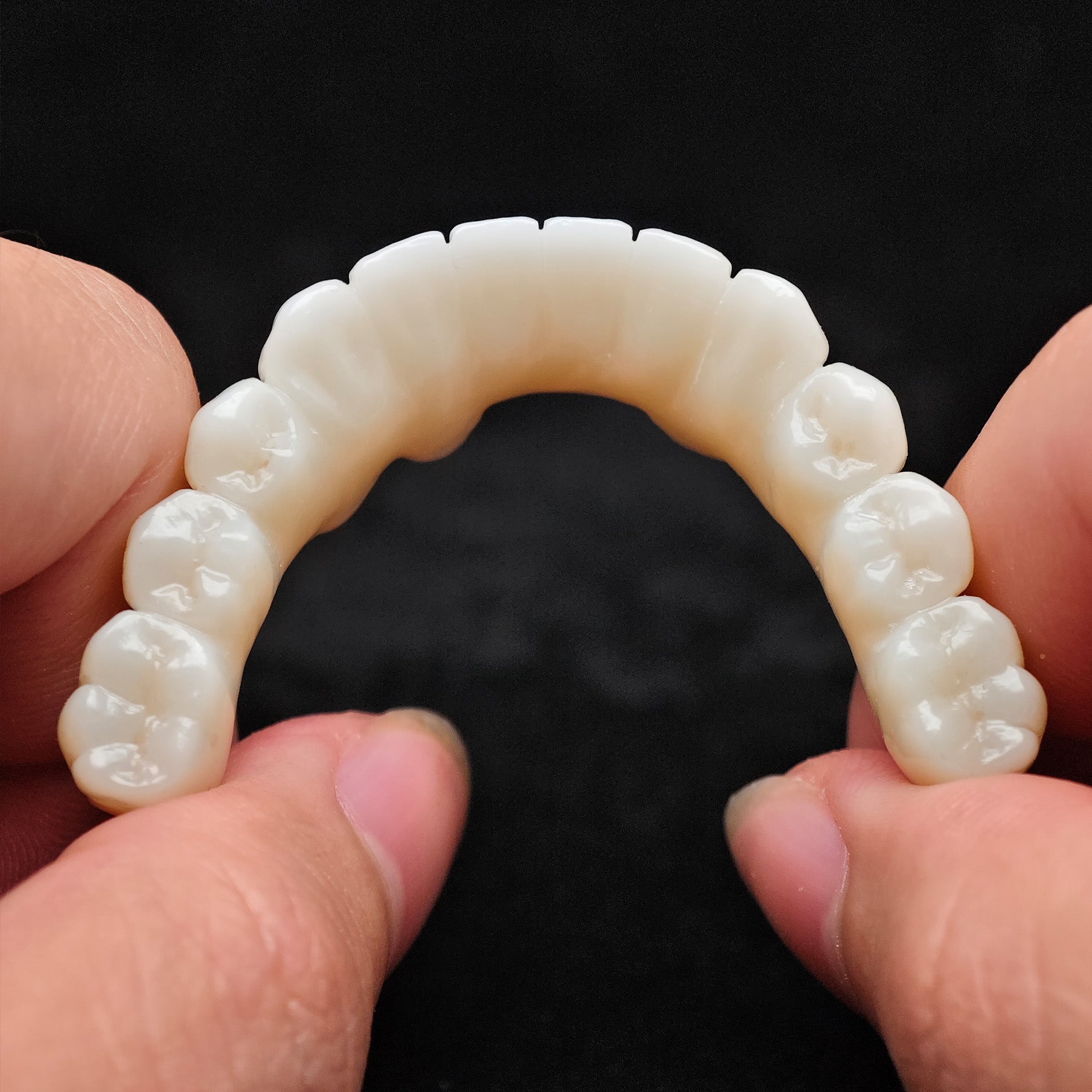 Zirconia Bridge With Cement Retained