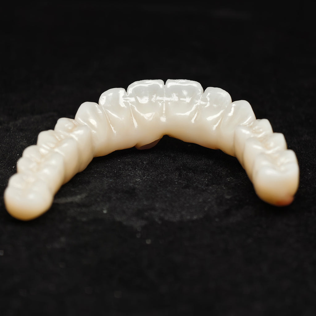 Zirconia Bridge With Cement Retained