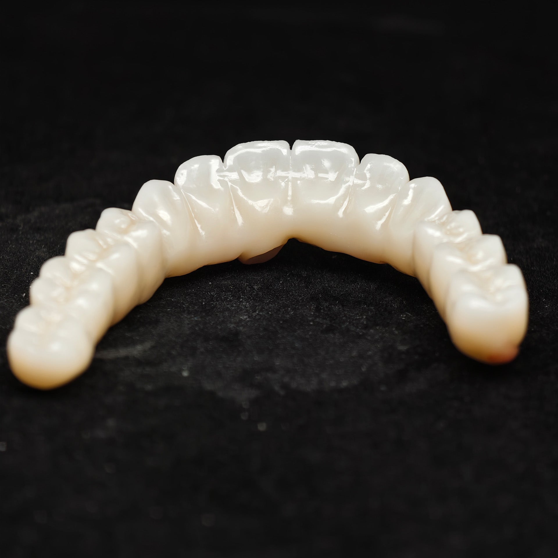Zirconia Bridge With Cement Retained