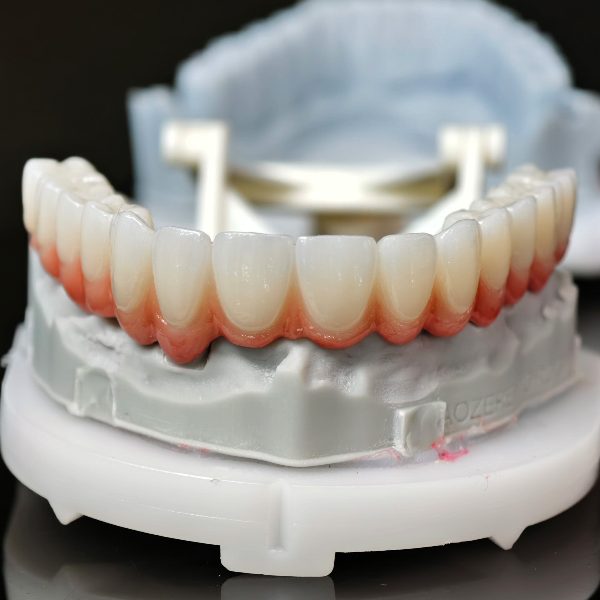 Zirconia Bridge With Cement Retained And Titanium Bar