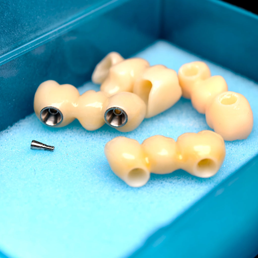 Zirconia Bridge With Ti-Base Screw Retained