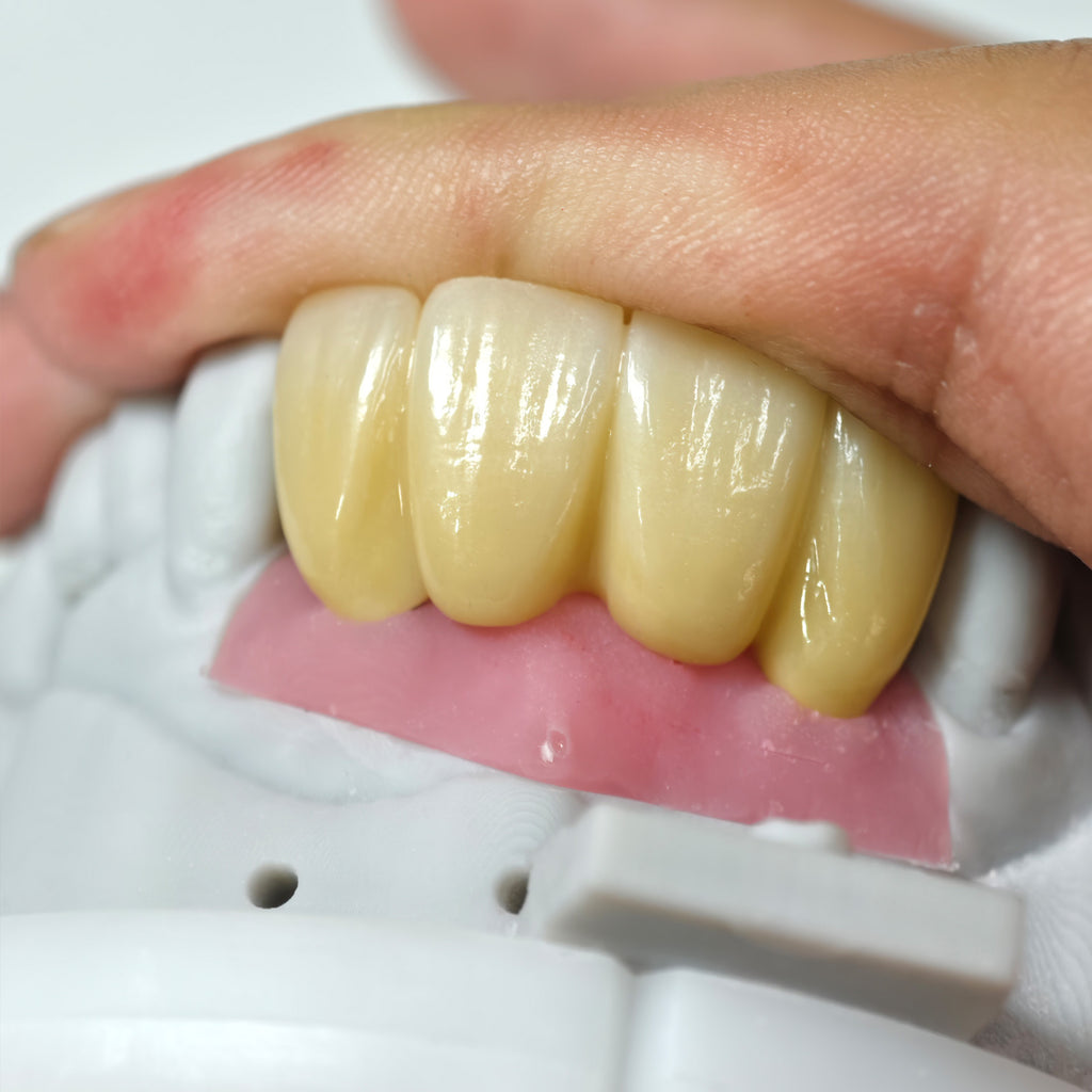 Zirconia Implant Bridge Screwmentable Dental Crown