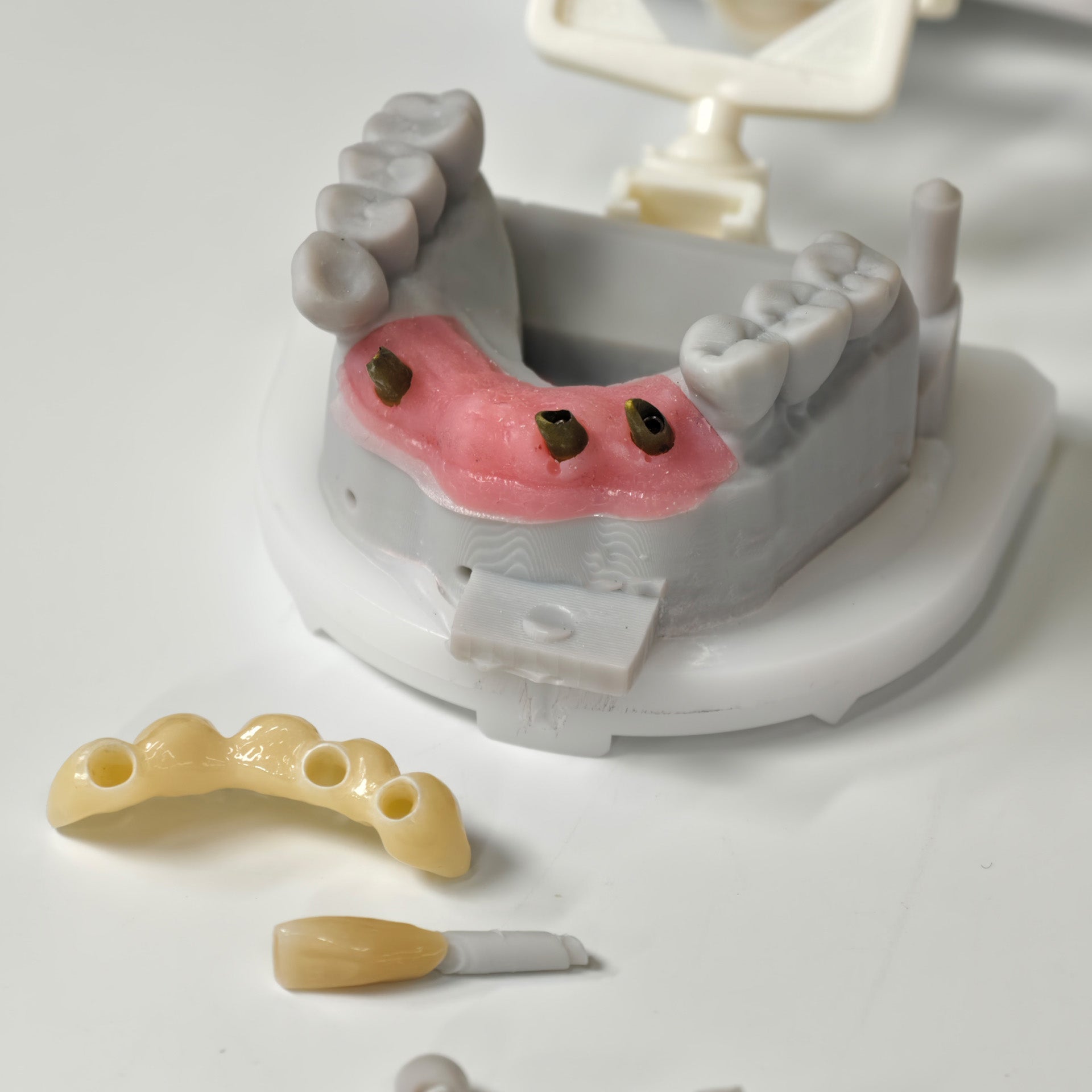Zirconia Implant Bridge Screwmentable Dental Crown