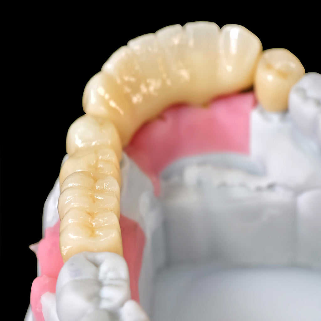 Zirconia Implant Bridge Screwmentable Dental Crown