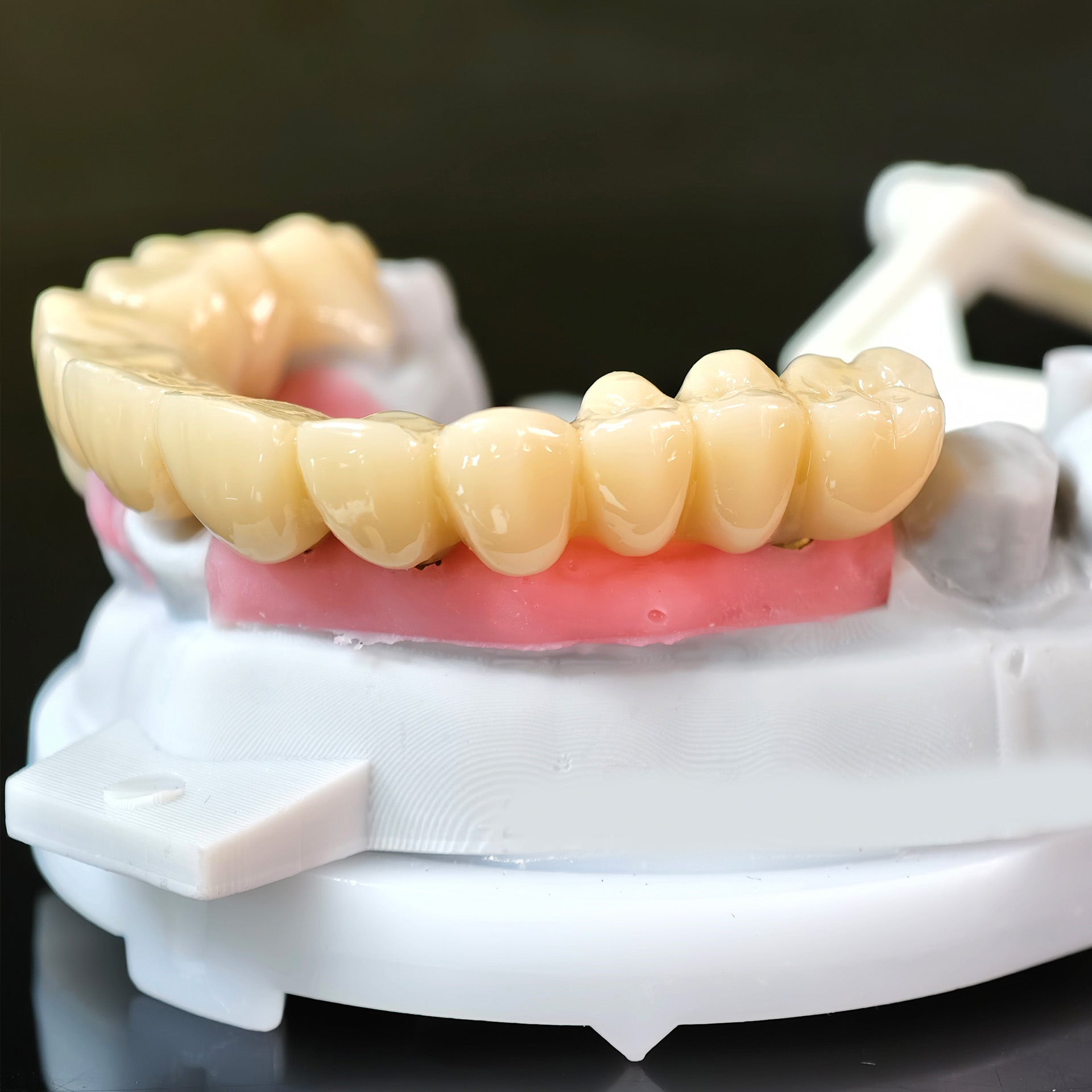Zirconia Implant Bridge Screwmentable Dental Crown