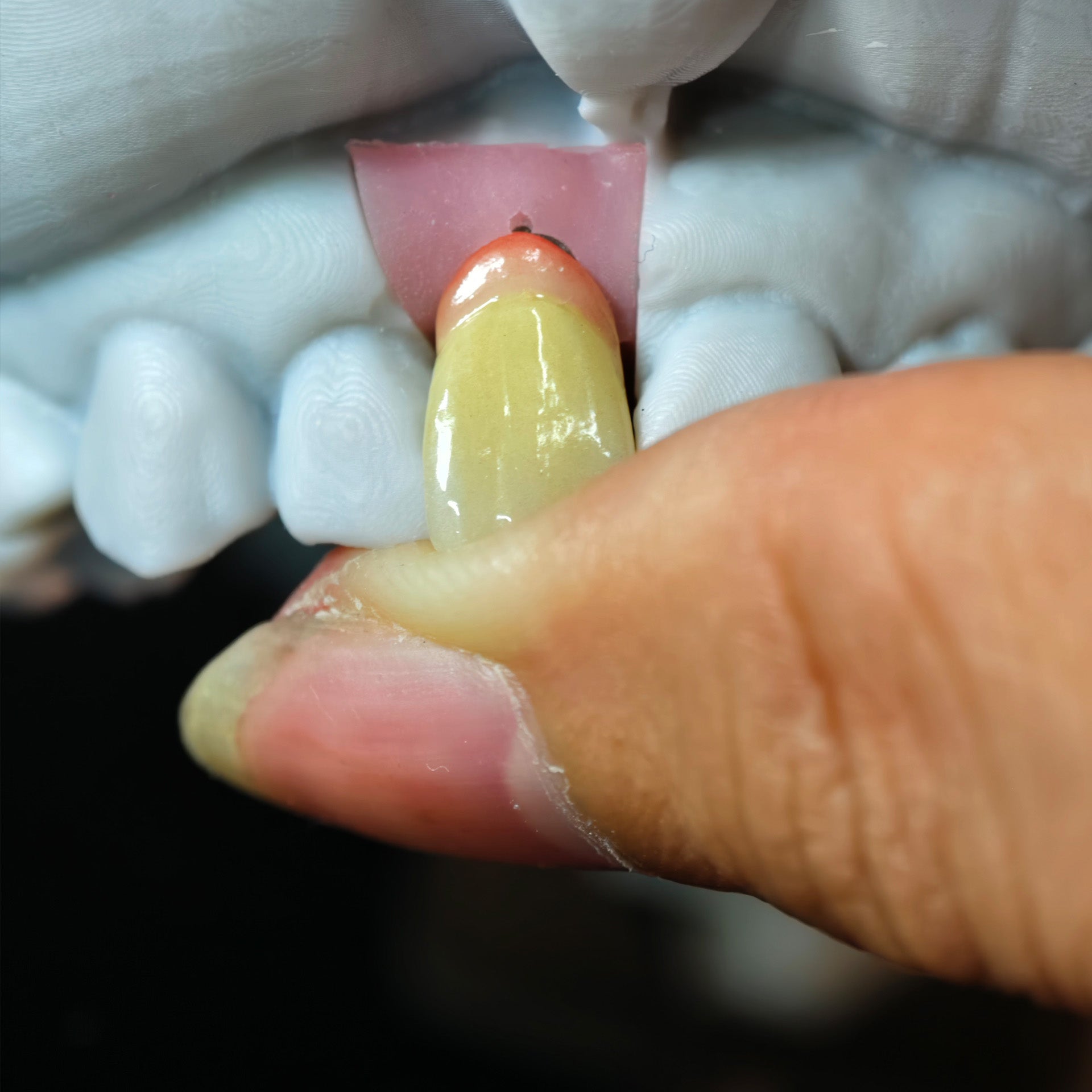 Zirconia Implant Crown Screwmentable Dental Crown