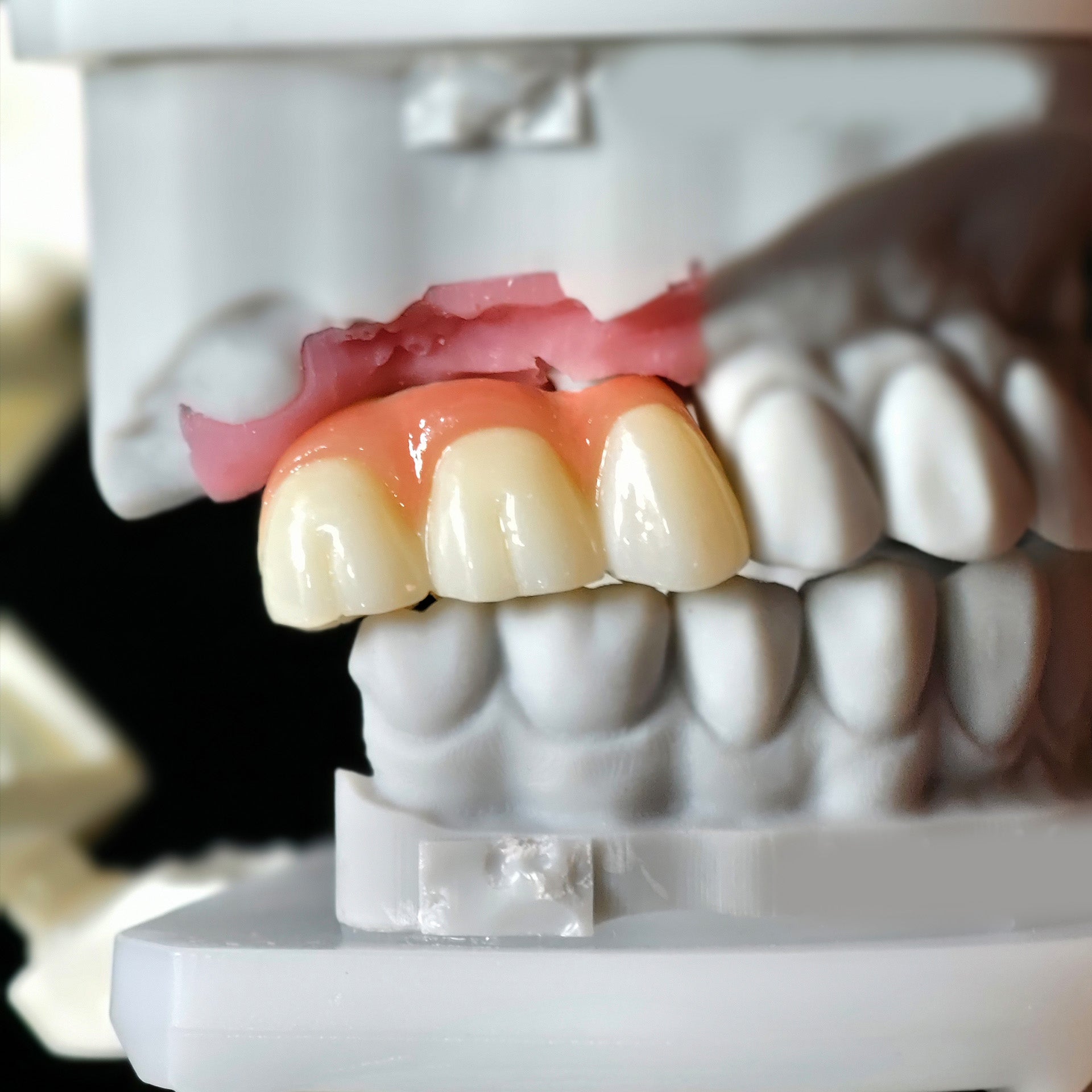 Zirconia Implant Crown Screwmentable Dental Crown