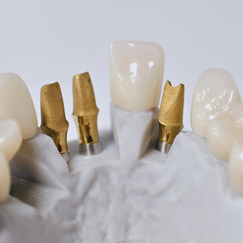 Zirconia Implant Crown And Bridge Screwmentable Dental Crown