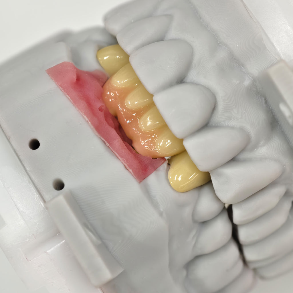Zirconia Implant Crown And Bridge Screwmentable Dental Crown