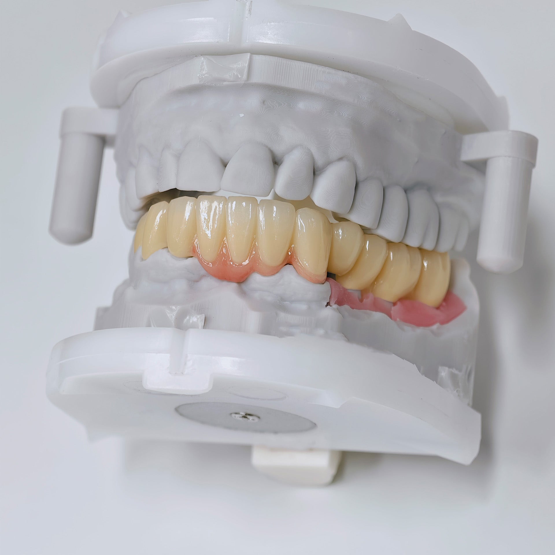 Zirconia Implant Crown And Bridges Screwmentable Dental Crown