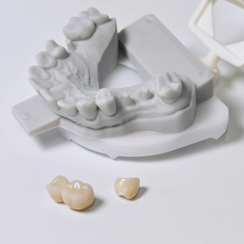 Zirconia Implant Crowns And Bridges Screwmentable Dental Crown