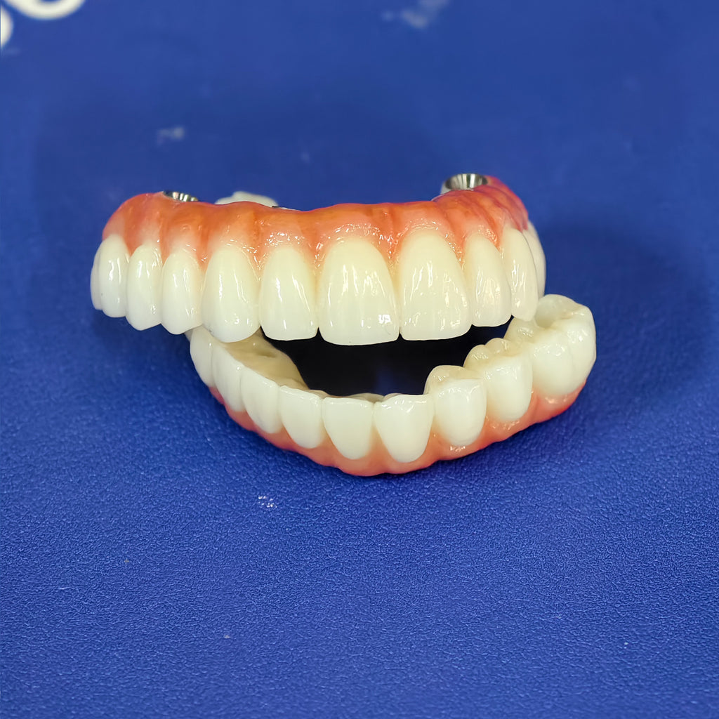 All On 4 Zirconia Bridge With Ti-Base Screw Retained Trying For Full Arch Restoration