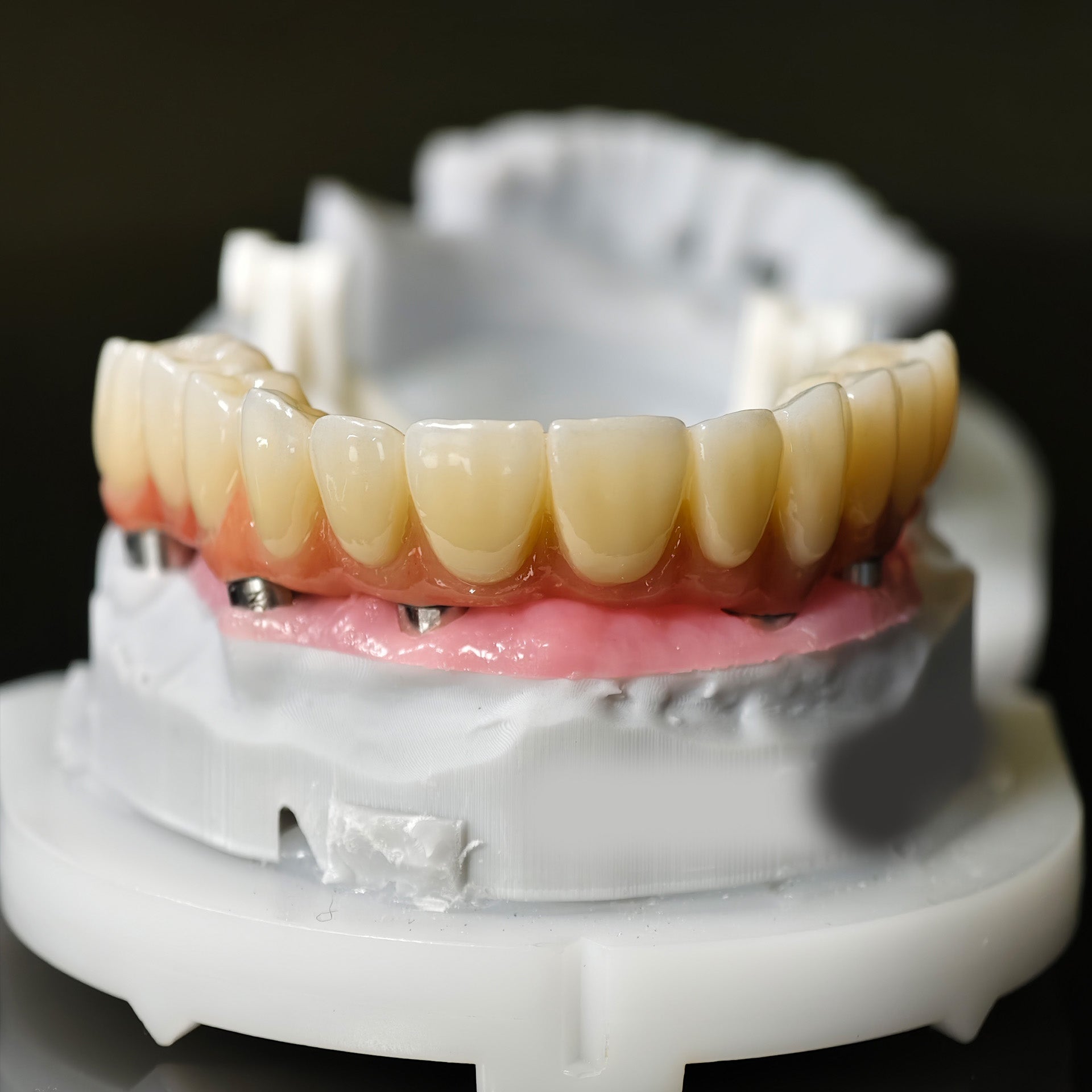 All On 5 Zirconia Bridge With Ti-Base Screw Retained Trying For Full Arch Restoration